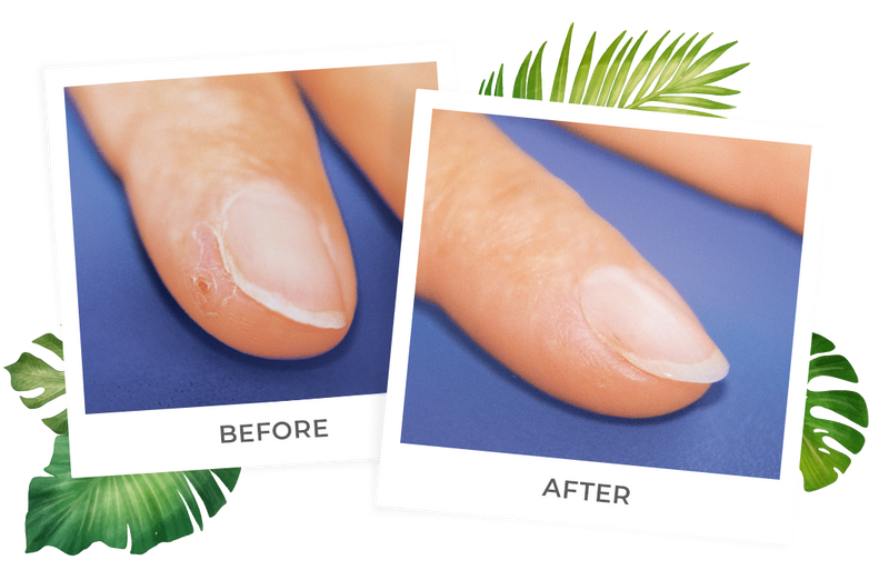 split finger lotion