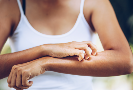 Revolutionary Dry Skin Lotion Targets #1 Cause of Eczema