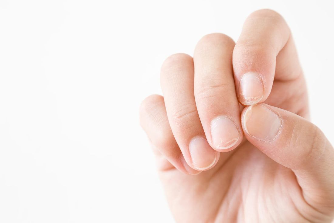 cracks on fingertips