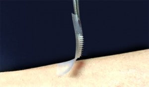New Smart Insulin Patch Could Change Everything