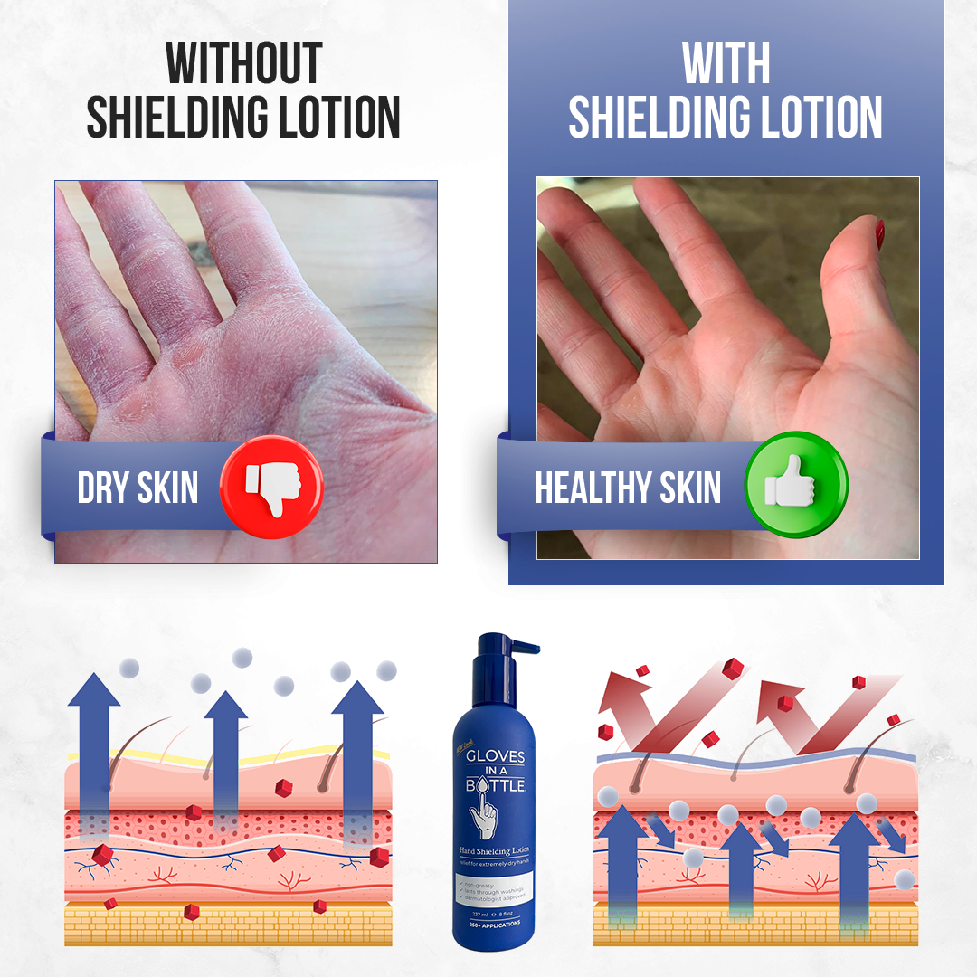 Baby & newborn eczema cream at glovesinabottle.com