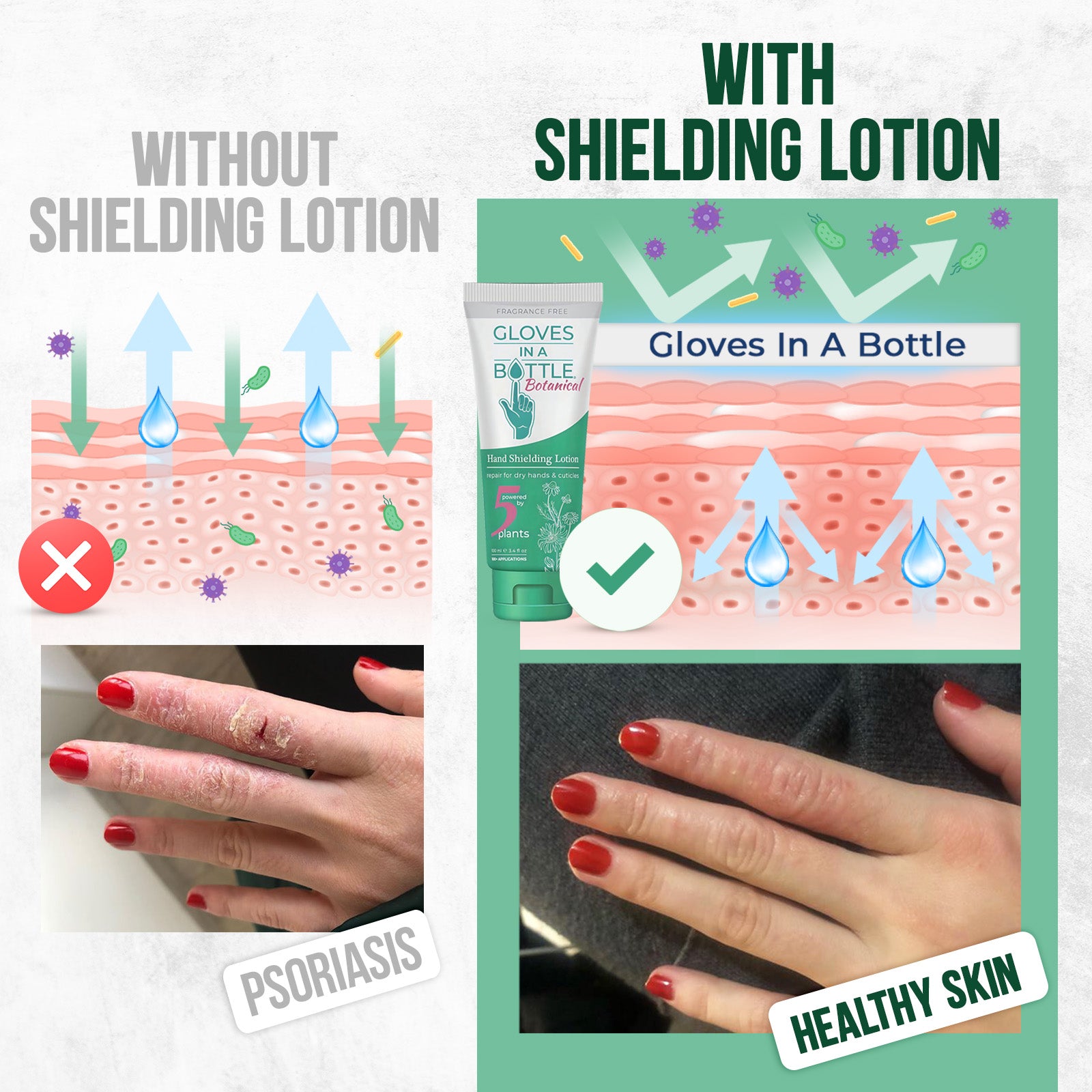 Hand Shielding Lotion with SPF, 2 pack