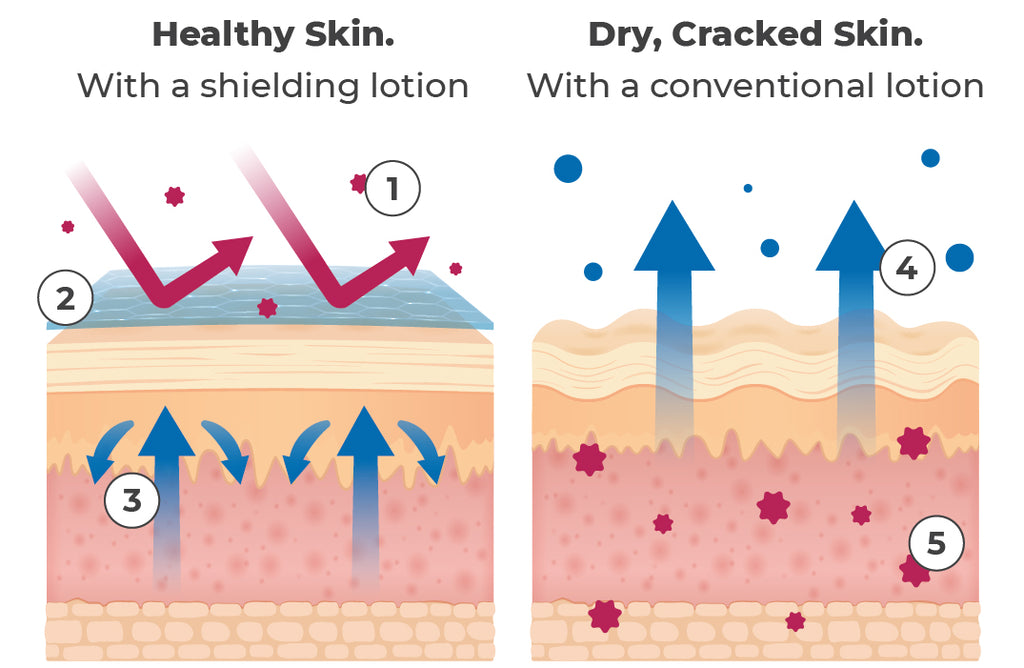 how to cure eczema