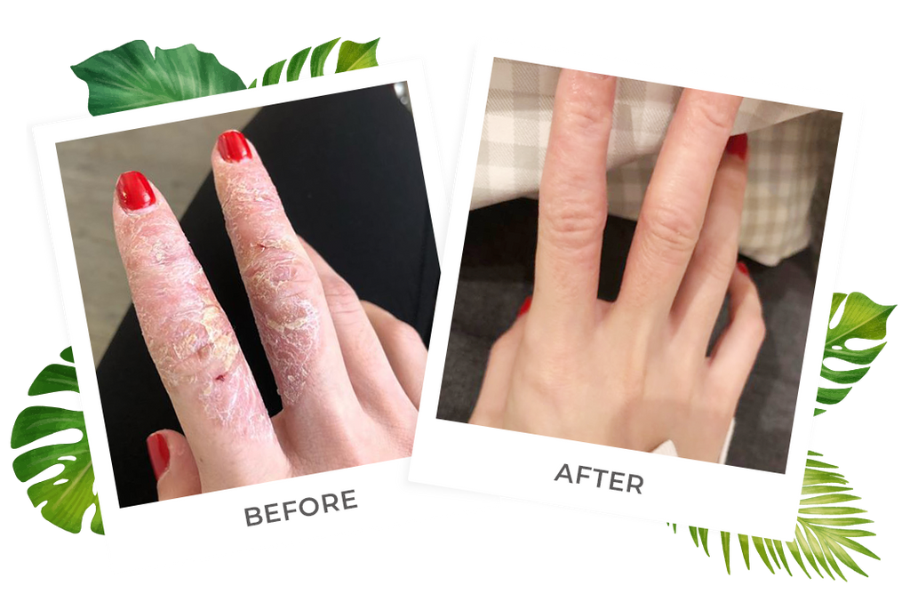 dry skin hand lotion