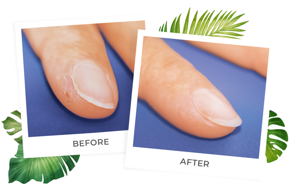 split finger lotion