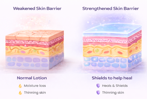 Comparison: weakened vs strengthened skin barrier