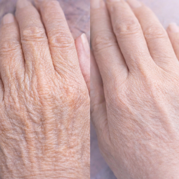 Aging vs healthier skin comparison